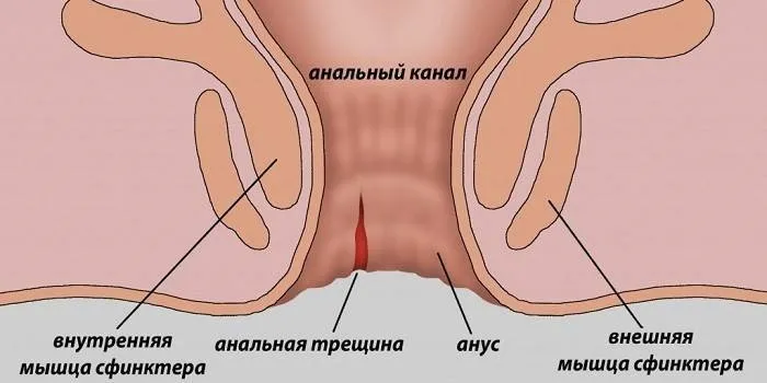 Hemoroxin