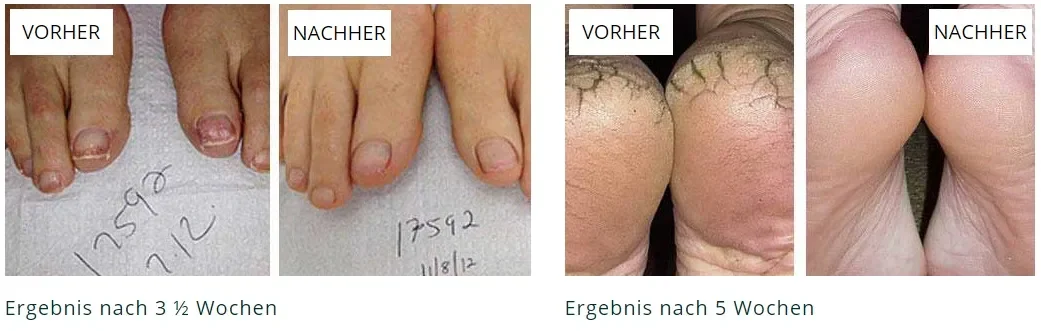 Promicil : složení pouze přírodní složky.