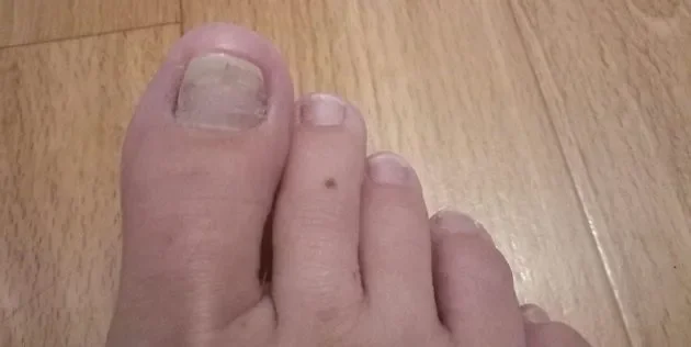 Softisenil : složení pouze přírodní složky.